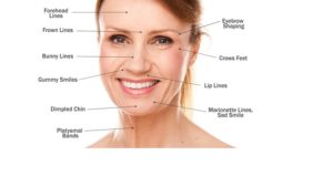 Read more about the article Cosmetic Surgery Treatments For Frown Lines On Face