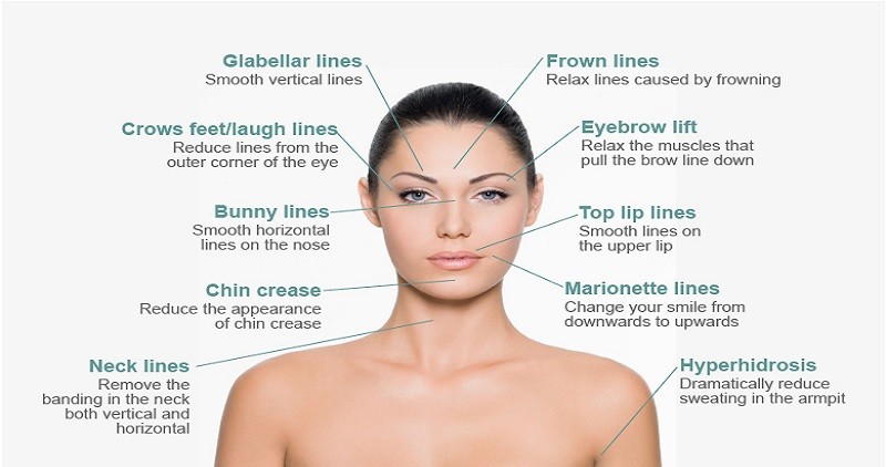 Cosmetic Surgery For Frown Lines On Face