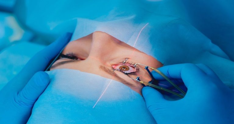 Laser Eye Surgery