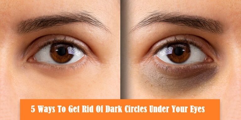 Ways to Get Rid of Dark Circles Under Your Eyes