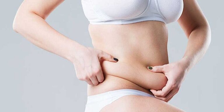 Medical Benefits of Tummy Tuck in Turkey