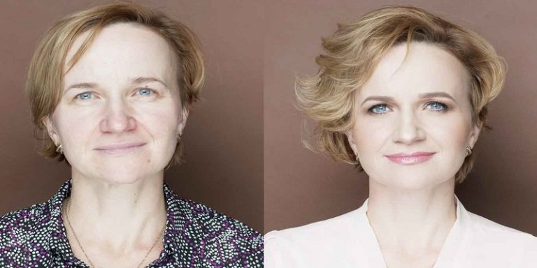 hair-toppers-before-and-after