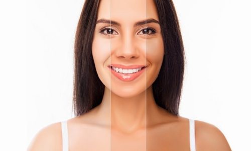 Best cleaners and whitening creams for dark Skin – Tips to Pick the Best Skin Whitener Based on Your Skin Type