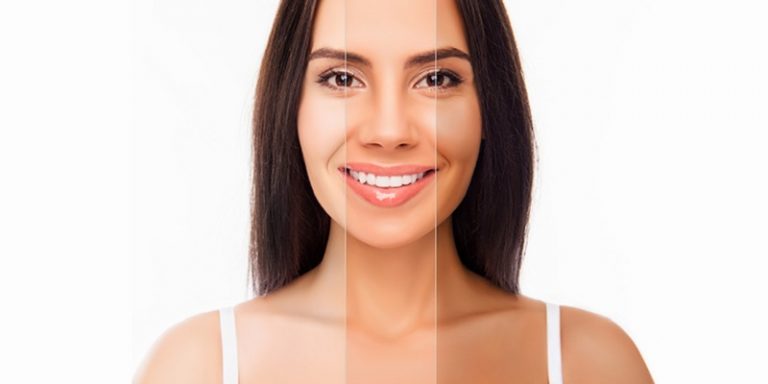 Best cleaners and whitening creams for dark Skin