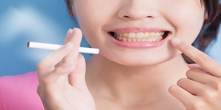 Can You Smoke After Lip Fillers