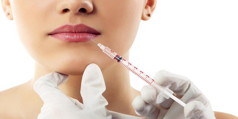 You are currently viewing How Soon After Lip Injections Can You Get More?