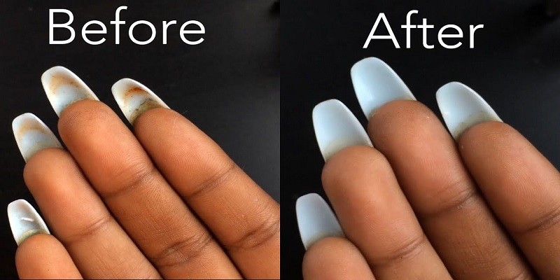 You are currently viewing How To Clean Under Acrylic Nails?