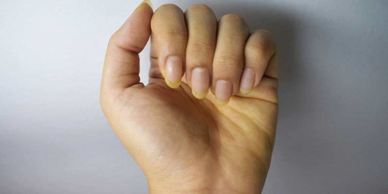 How To Remove Turmeric Stains From Nails