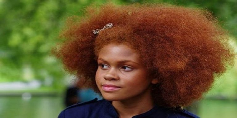 Can Black People Have Red Hair