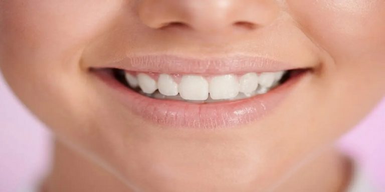Can You Smile After Lip Fillers