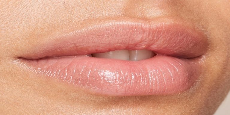 How Long To Lip Fillers Last