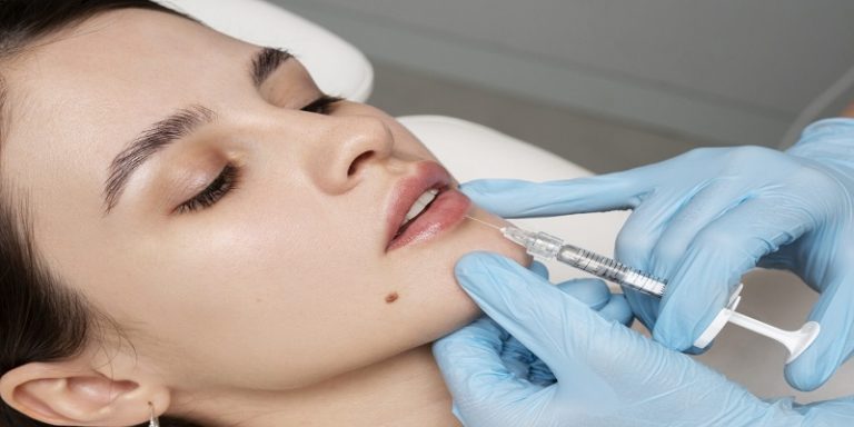 How Many Syringes For Lip Filler