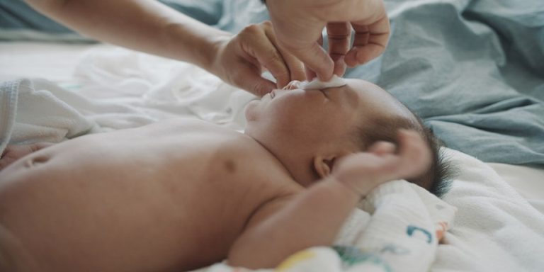 How To Get Hair Out Of Baby Eye