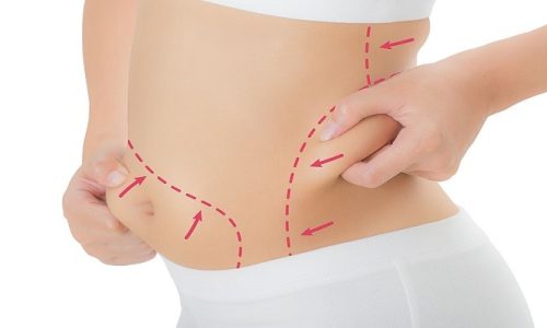 How To Get Rid Of Hardness After Lipo?