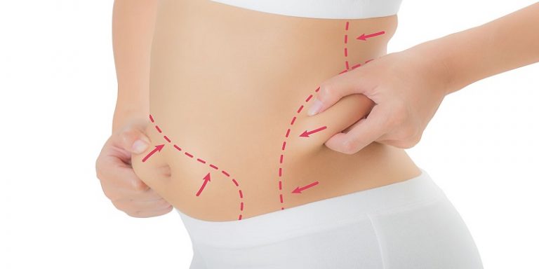 How To Get Rid Of Hardness After Lipo