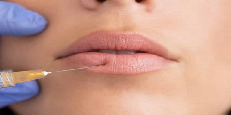 How To Massage Lip Filler Lumps
