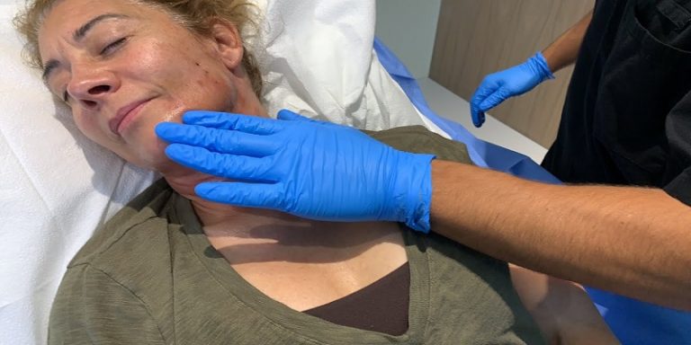 How To Massage Your Chin After Lipo