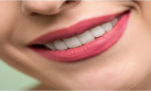 Four Beauty Tips to Improve Your Smile