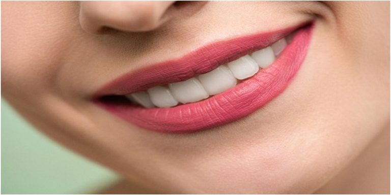 Four Beauty Tips to Improve Your Smile