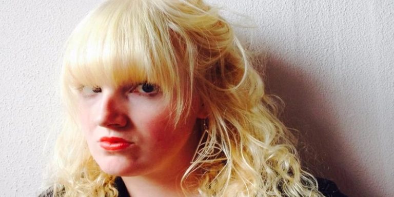 Can Albinos Dye Their Hair