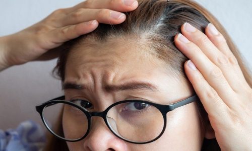 Can Dehydration Cause Hair Loss?