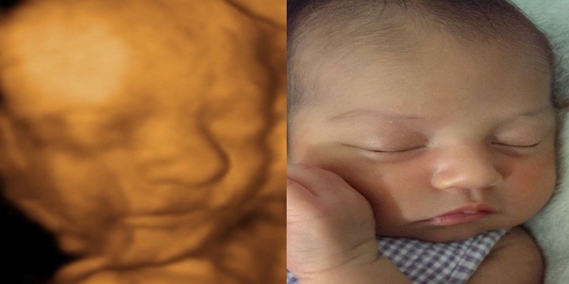 You are currently viewing Can You See Hair On 3D Ultrasound?