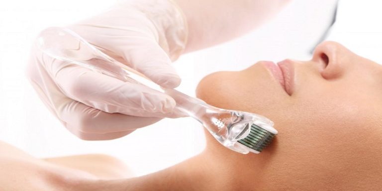 Can You Wear Makeup After Micro Needling