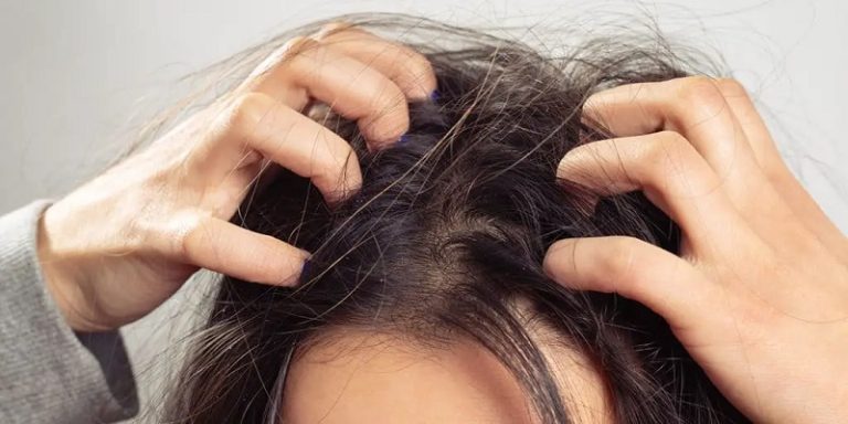 How Do You Get Dried Blood Out Of Hair