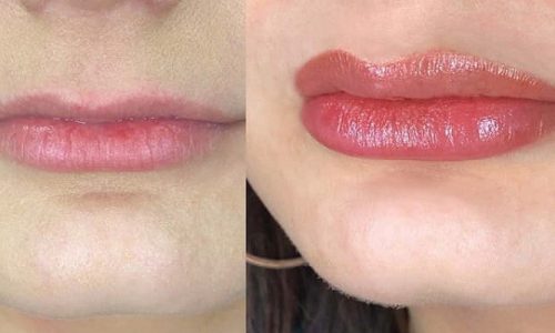 How Long Does Lip Blushing Take To Heal?