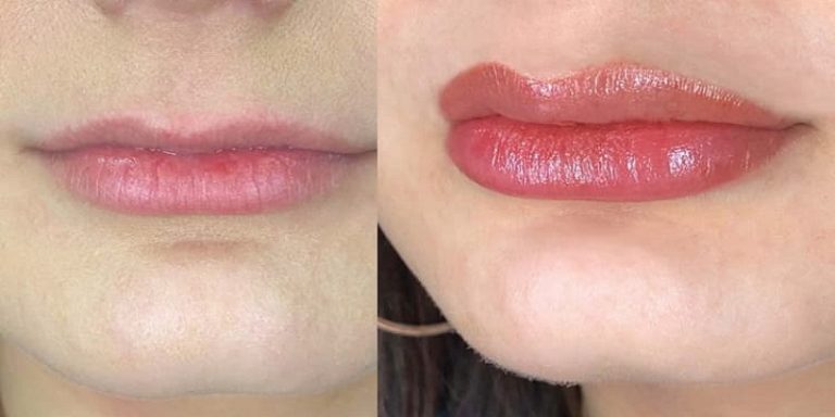 How Long Does Lip Blushing Take To Heal