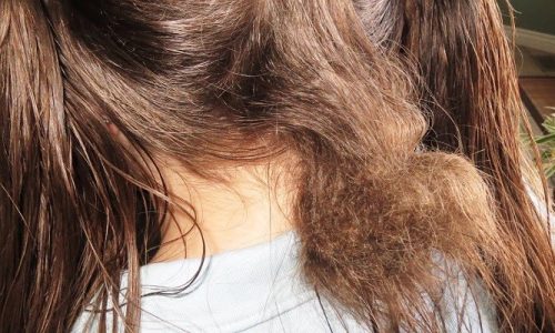 How To Get A Rat Nest Out Of Hair?