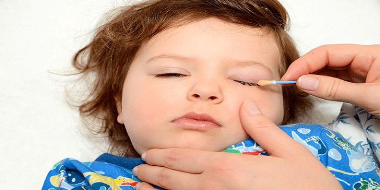 How To Get Hair Out Of Baby'S Eye