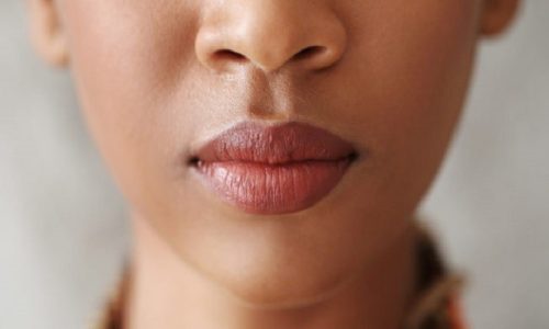 How To Get Rid Of Smoker Lips?