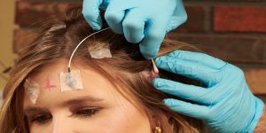 Read more about the article How To Remove Electrode Glue From Hair?