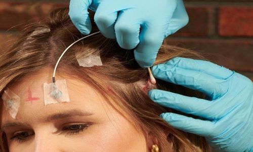 How To Remove Electrode Glue From Hair?