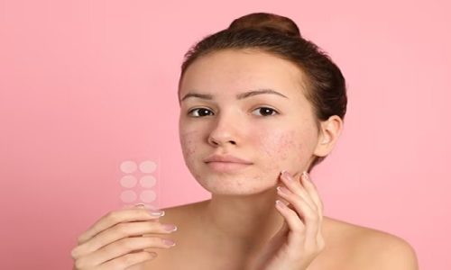 Can I Put Makeup Over A Pimple Patch?