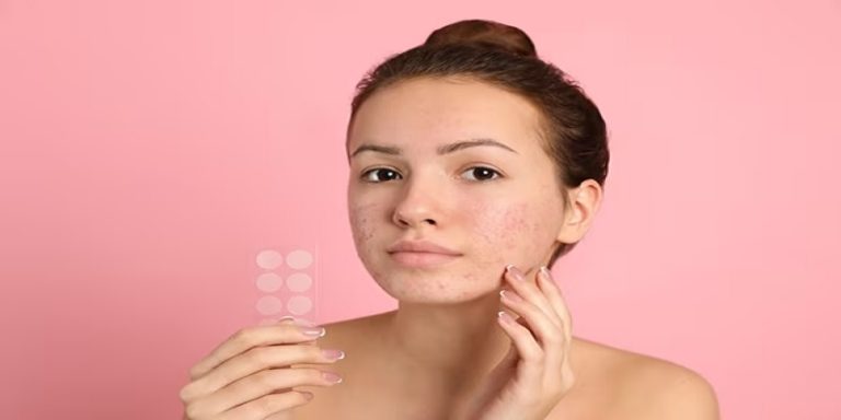 Can I Put Makeup Over A Pimple Patch