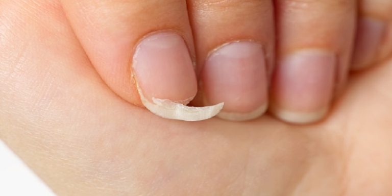 How To Safely Remove A Broken Acrylic Nail That's Bleeding
