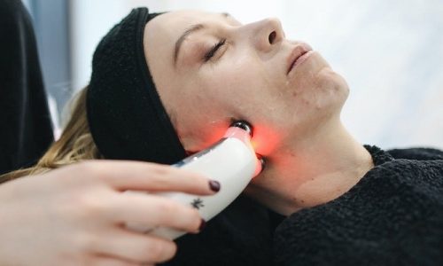 Things you must know before getting Laser Treatment for the Skin