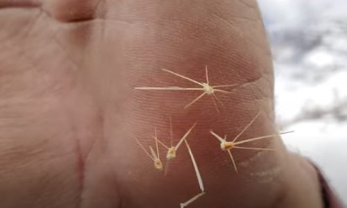 How To Get Tiny Cactus Needles Out Of Skin?