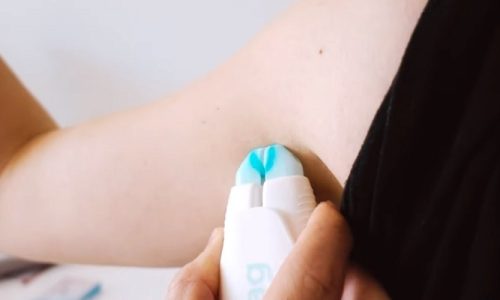 Does Bliss Skin Tag Remover Work?