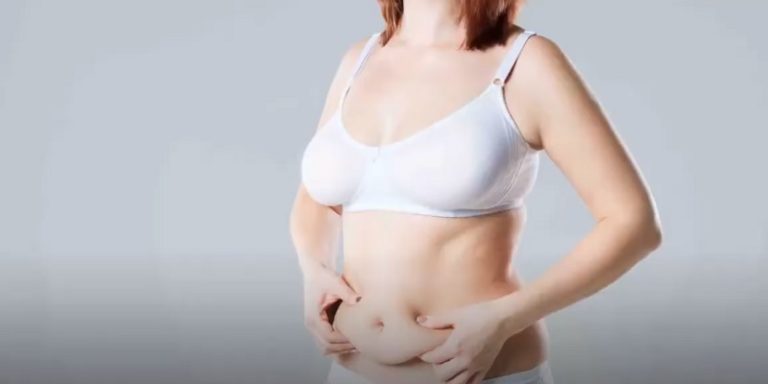 Does Medicaid Cover Skin Removal Surgery