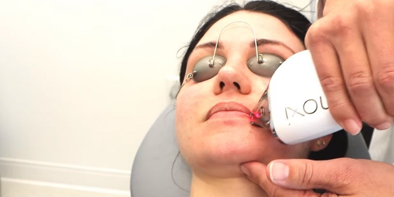 Does Moxi Laser Tighten Skin