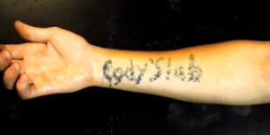 How To Remove Silver Nitrate From Skin? - GA Fashion