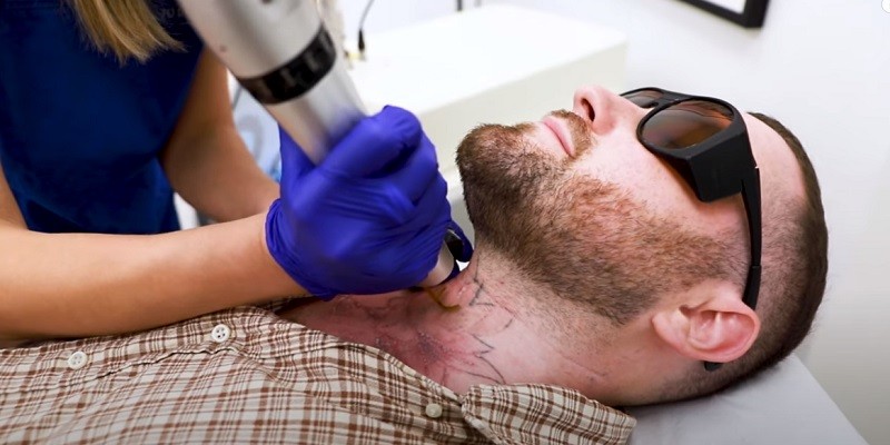 You are currently viewing How To Become A Laser Tattoo Removal Technician?