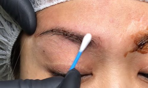 How To Remove Eyebrow Tattoo At Home?