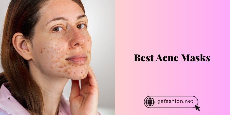 11 Best Acne Masks Of 2025