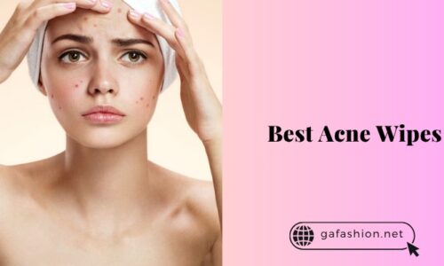 The 10 Best Acne Wipes – 2025