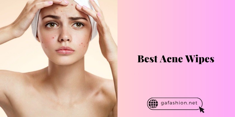 The 10 Best Acne Wipes – 2025