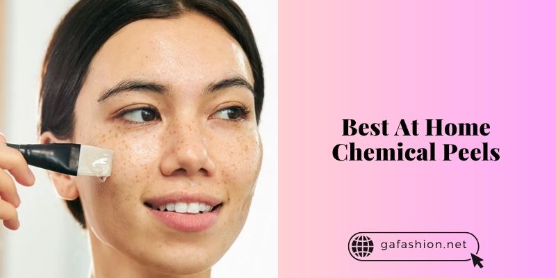 best at home chemical peels